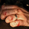 bloody-knuckles bloody-knuckles